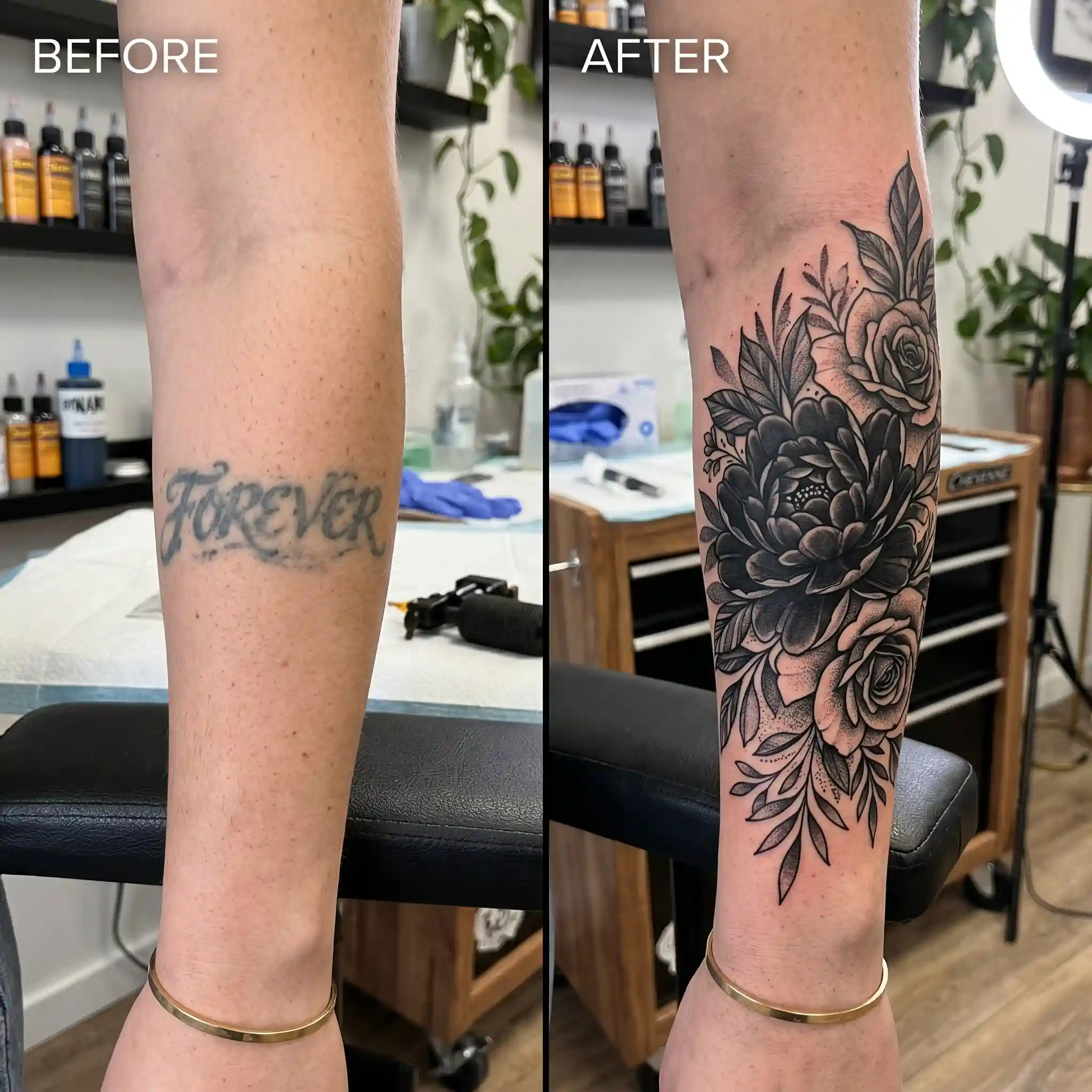 Flower-Cover-Up-Tattoo